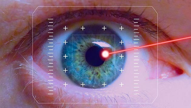 Лазерная коагуляция сетчатки глаза в клинике Медведева